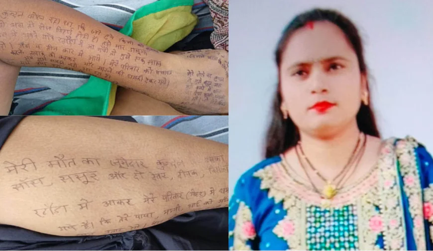 दहेज की आग में जली बेटी: शरीर पर लिखा ससुराल की सताई दर्दनाक कहानी
