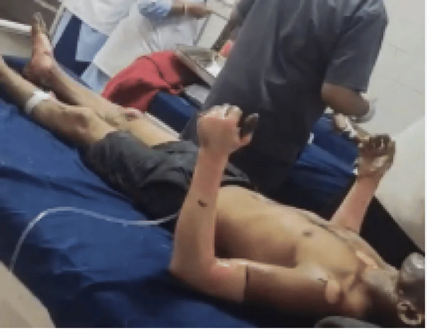 चूल्हा जलाते ही लगी भीषण आग, एक ही परिवार के चार झुलसे, गीता मीणा की हालत गंभीर