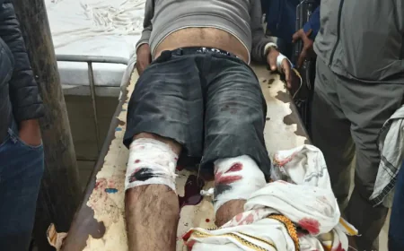 पुलिस और हिस्ट्रीशीटर के बीच जबरदस्त मुठभेड़: 15 राउंड फायरिंग, बदमाश के दोनों पैरों में लगी गोली, बुलटी गैंग का सरगना दबोचा गया