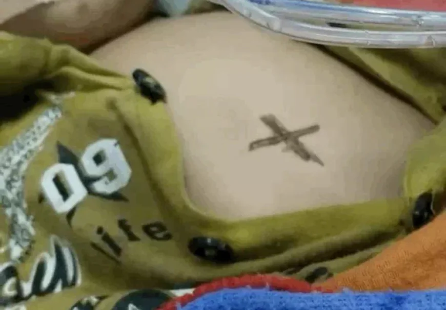 भीलवाड़ा में अंधविश्वास का शिकार हुआ 9 महीने का मासूम: निमोनिया के 'इलाज' में गर्म सरिए से दागा, 3 दिन वेंटिलेटर पर संघर्ष के बाद तोड़ा दम