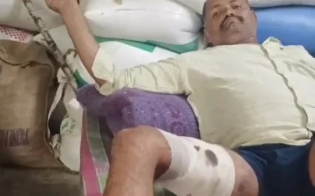 भरतपुर: आवारा सांड के हमले में युवक गंभीर रूप से घायल, पैर में आए 30 टांके