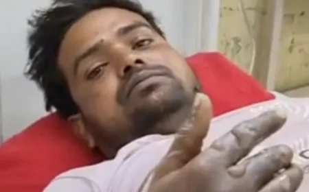 अलवर: अलाव तापते समय डीजल डालने से टैंक में जोरदार धमाका, 30 वर्षीय युवक गंभीर रूप से झुलसा