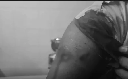 बीकानेर: मामूली विवाद में चाकूबाजी, 11वीं की छात्रा ने 12वीं की सीनियर पर किया हमला