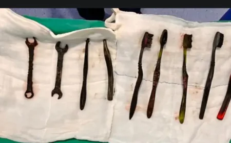 जयपुर में युवक के पेट से निकाले गए 7 टूथब्रश और 2 लोहे के पाने: डॉक्टर भी रह गए हैरान