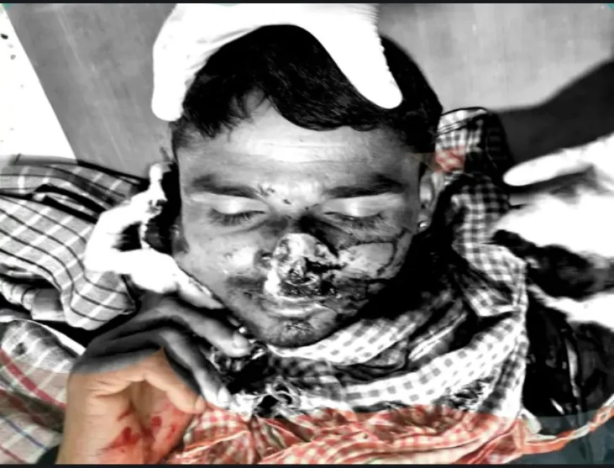 बाड़मेर में लव मैरिज से उपजा पुराना विवाद: जेठ की नाक काटी, जवाब में चाचा का पैर तोड़ा