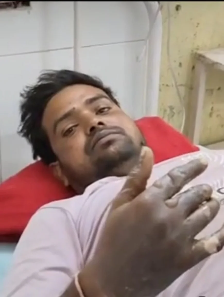 अलवर: अलाव तापते समय डीजल डालने से टैंक में जोरदार धमाका, 30 वर्षीय युवक गंभीर रूप से झुलसा