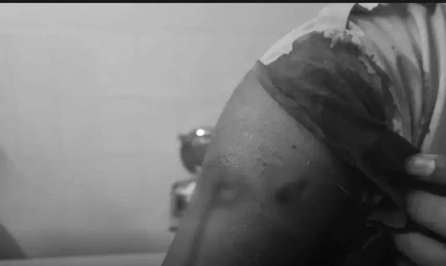 बीकानेर: मामूली विवाद में चाकूबाजी, 11वीं की छात्रा ने 12वीं की सीनियर पर किया हमला