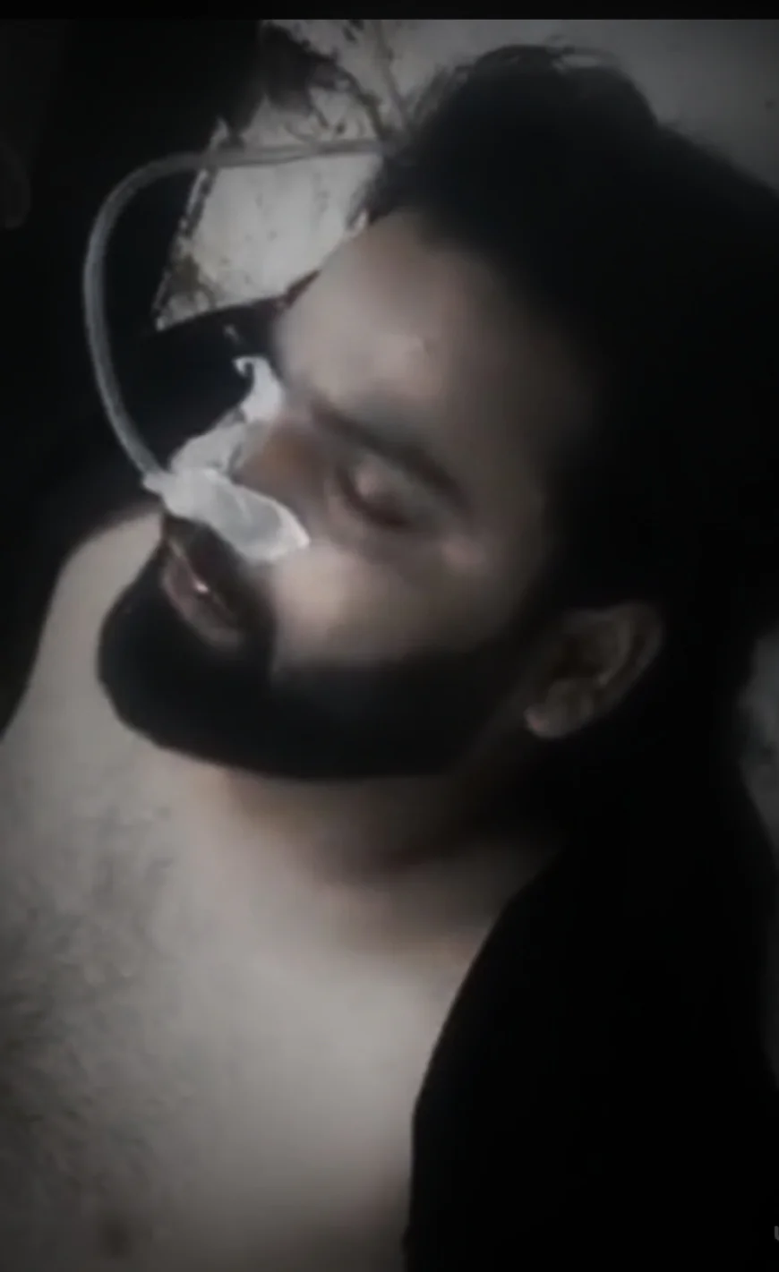 कोटा मैरिज गार्डन फायरिंग मामला: पुरानी रंजिश में शादी समारोह के दौरान चली गोलियां, एक युवक घायल