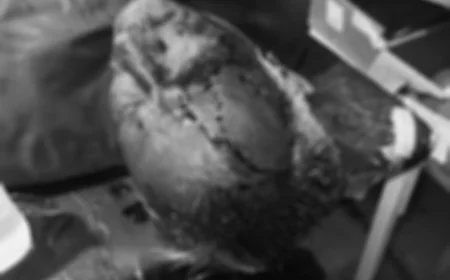 नागौर के लूणदा गांव में मकर संक्रांति की शाम हुआ खूनी हमला: पीड़ितों को खुलेआम धमकियां, पुलिस कार्रवाई पर सवाल