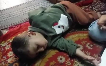 बच्चे के दिल में छेद: सरकारी टीम ने क्रेडिट लिया, परिवार ने कहा - हमने खुद करवाया ऑपरेशन, CMHO का दावा झूठा