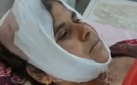 रास्ते के पुराने विवाद में परिवारजनों ने ही दिखाई दबंगई: बेटे के सामने मां का सिर फोड़ा, लहूलुहान किया – लाठी-डंडों और लोहे की रॉड से किया हमला, चौथी बार हुई मारपीट