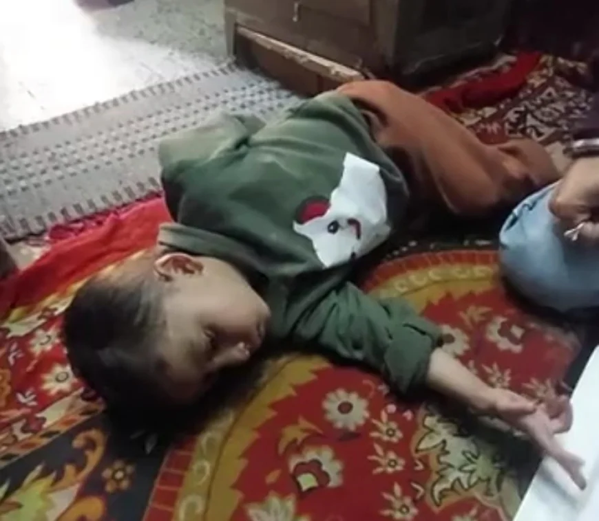 बच्चे के दिल में छेद: सरकारी टीम ने क्रेडिट लिया, परिवार ने कहा - हमने खुद करवाया ऑपरेशन, CMHO का दावा झूठा