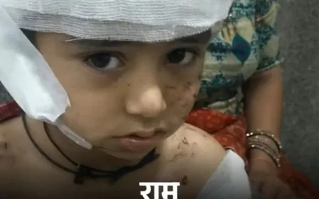 स्कूल में पहले ही दिन मासूम पर आवारा कुत्तों का क्रूर हमला: सिर की आधी चमड़ी खा गए, कान काट डाला, पूरा शरीर नोचा; प्लास्टिक सर्जरी जरूरी, इलाज में लग सकता है एक साल