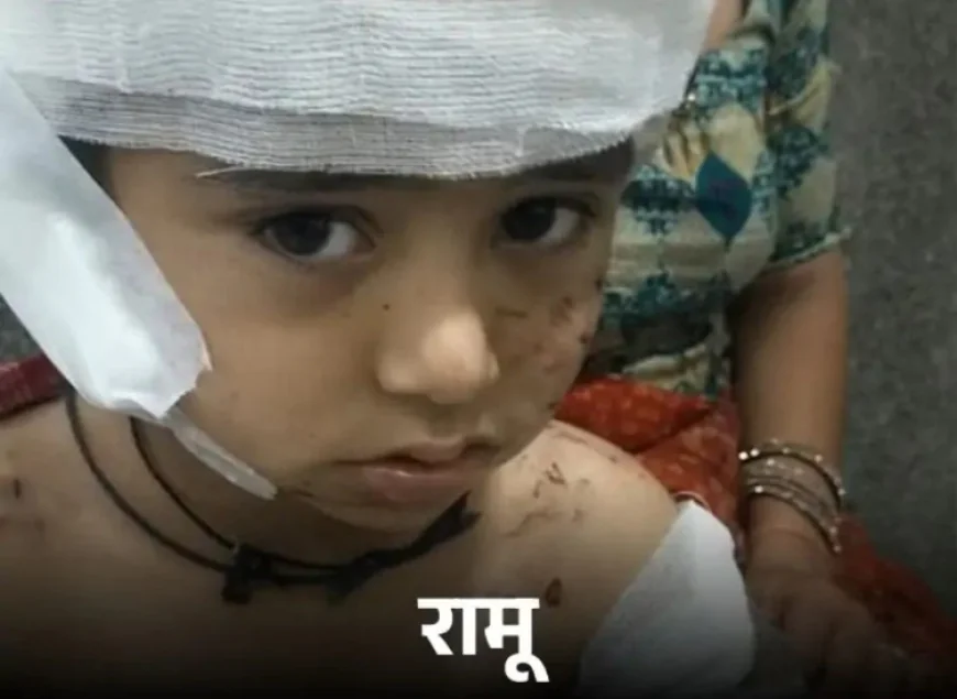 स्कूल में पहले ही दिन मासूम पर आवारा कुत्तों का क्रूर हमला: सिर की आधी चमड़ी खा गए, कान काट डाला, पूरा शरीर नोचा; प्लास्टिक सर्जरी जरूरी, इलाज में लग सकता है एक साल