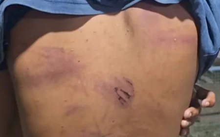 बालोतरा में प्रेम प्रसंग की कीमत: युवक को गर्म तार से पीटा, जबरन पेशाब पिलाने और निर्वस्त्र वीडियो बनाने का गंभीर आरोप