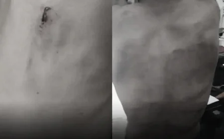 उदयपुर की झाड़ोल उप कारागृह में कैदियों पर जेलर-प्रहरियों की बेरहम मारपीट: जज के सामने दिखाए चोट के निशान, तीन मुकदमे दर्ज