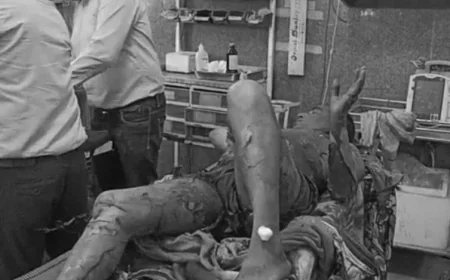 बीकानेर एसपी कार्यालय के सामने युवक ने खुद को आग लगाई: 80% झुलसा, पुलिस ने बचाया; महिला परेशान करने के आरोप में ज्ञापन देने पहुंचा था