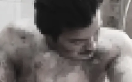 चार्जिंग मोबाइल के पास रखी पेट्रोल बोतल बनी जानलेवा: अलवर में धमाके से युवक 60% झुलसा, अस्पताल में भर्ती