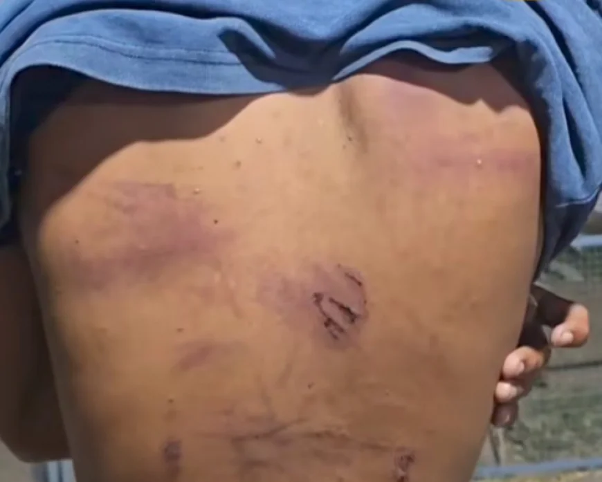 बालोतरा में प्रेम प्रसंग की कीमत: युवक को गर्म तार से पीटा, जबरन पेशाब पिलाने और निर्वस्त्र वीडियो बनाने का गंभीर आरोप