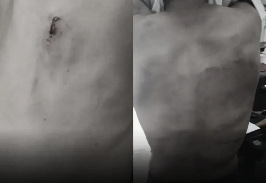 उदयपुर की झाड़ोल उप कारागृह में कैदियों पर जेलर-प्रहरियों की बेरहम मारपीट: जज के सामने दिखाए चोट के निशान, तीन मुकदमे दर्ज