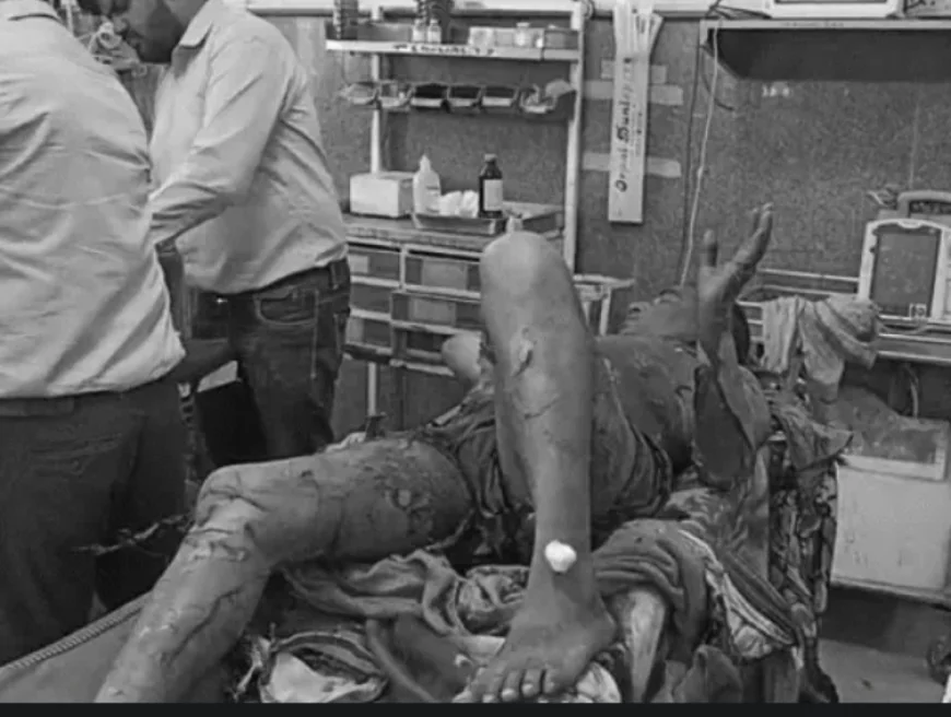 बीकानेर एसपी कार्यालय के सामने युवक ने खुद को आग लगाई: 80% झुलसा, पुलिस ने बचाया; महिला परेशान करने के आरोप में ज्ञापन देने पहुंचा था