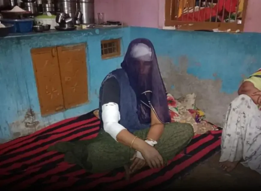 साहस की मिसाल: भीलवाड़ा में लेपर्ड के हमले से 3 मिनट तक भिड़ी महिला, दांतली से की बहादुरी से लड़ाई, जान बचाई