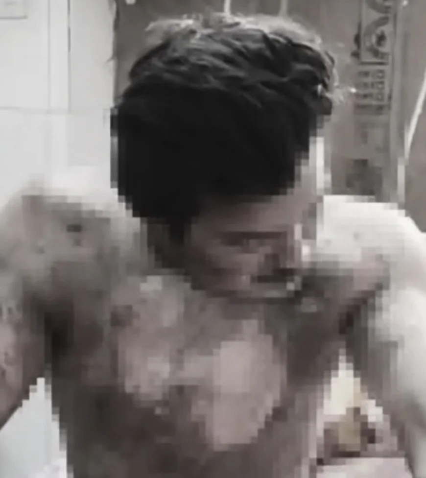 चार्जिंग मोबाइल के पास रखी पेट्रोल बोतल बनी जानलेवा: अलवर में धमाके से युवक 60% झुलसा, अस्पताल में भर्ती