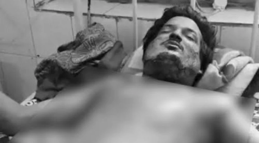 खाना खाते-खाते अचानक धमाका… मोबाइल बना हादसे की वजह!