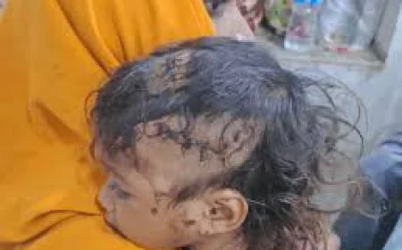 पाली में सो रही 2 साल की मासूम को कुत्ता घसीटकर ले जाने लगा, मां ने लाठी से हमला कर बचाई बेटी की जान
