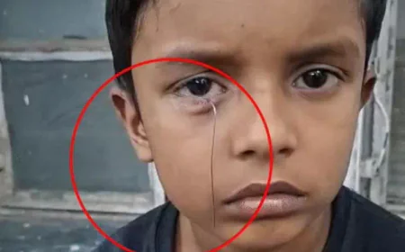 टॉय कार से निकला तार 8 साल के बच्चे की आंख में घुसा: दर्द से चीखा मासूम, डॉक्टरों ने ऑपरेशन कर बचाई आंख