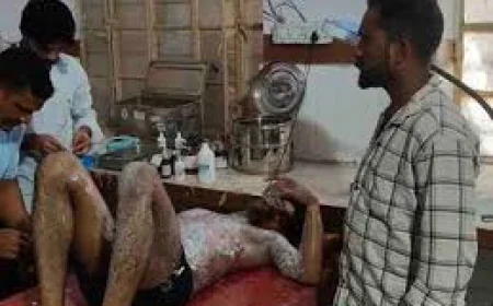 पिता की डांट से नाराज युवक रेलवे के बिजली पोल पर चढ़ा, करंट लगते ही बीच में अटका; हालत गंभीर
