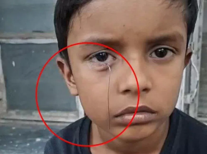 टॉय कार से निकला तार 8 साल के बच्चे की आंख में घुसा: दर्द से चीखा मासूम, डॉक्टरों ने ऑपरेशन कर बचाई आंख