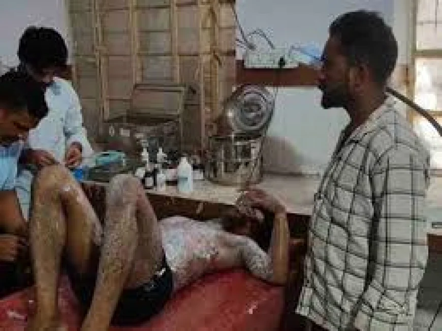 पिता की डांट से नाराज युवक रेलवे के बिजली पोल पर चढ़ा, करंट लगते ही बीच में अटका; हालत गंभीर