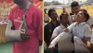 'साहब मेरा हाथ टूटा है...', निर्दयी सिस्टम ने एक न सुनी; उधर ट्रेनिंग में तड़प-तड़प कर बेसुध हुआ दूसरा शिक्षक!